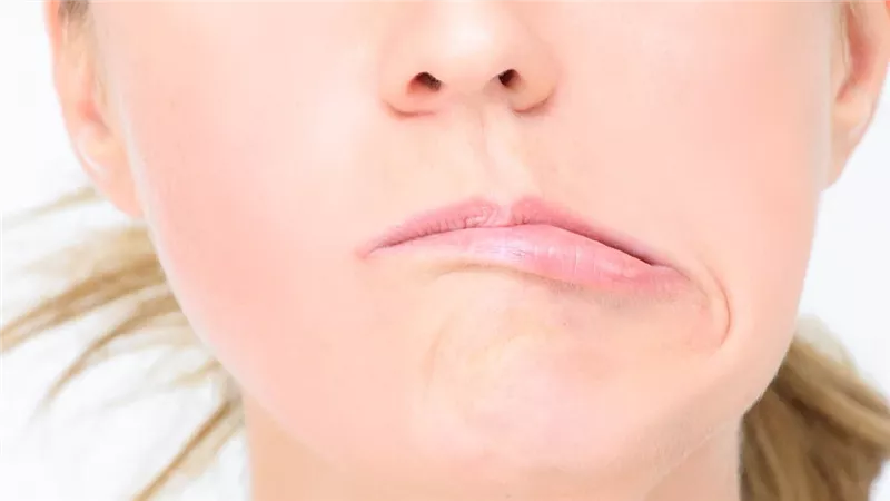 أسباب مرض العصب السابع وطرق علاجه في المنزل