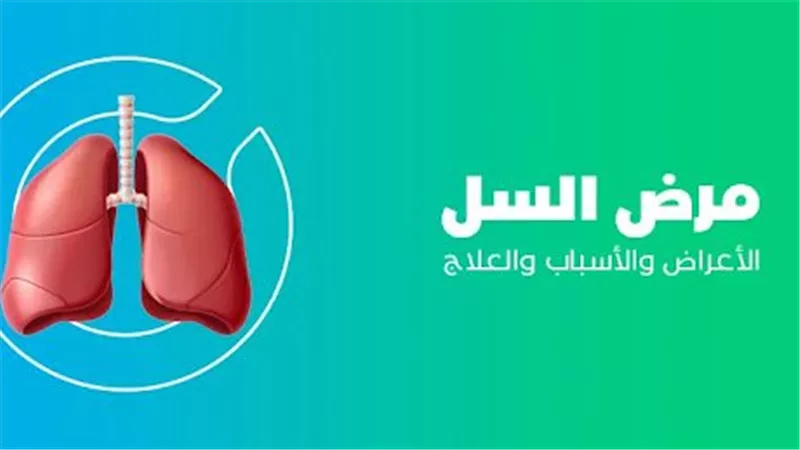مرض السل.. أعراضه وأسبابه وطريقة الوقاية منه؟