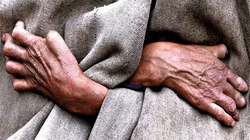 ما هو أصل مرض الجذام والدول المنتشر بها وكيفية علاجه؟