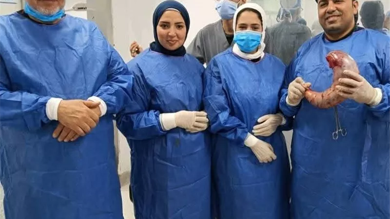 مستشفى جامعة الأزهر تجري عملية تكميم لمريض يزن (275) كيلو