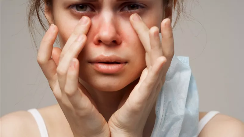 تحلل البشرة السُمي.. حالة نادرة وخطرة تُعالج بنجاح في مستشفى حورس بالأقصر