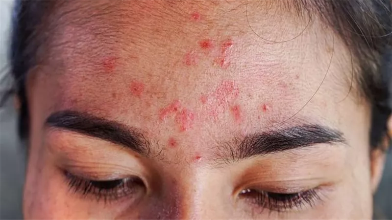 كيف يؤثر تراجع الكولاجين على نضارة الوجه وصحة الشعر؟
