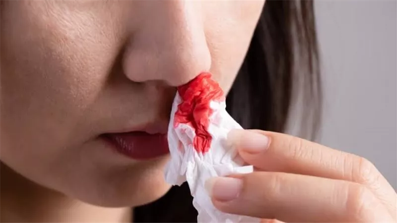 في موجة الحر.. كيف تتعامل مع نزيف الأنف في فصل الصيف؟