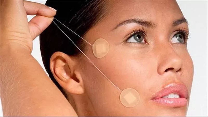 خيوط التجميل الحل السحري لإخفاء التجاعيد قبل العيد