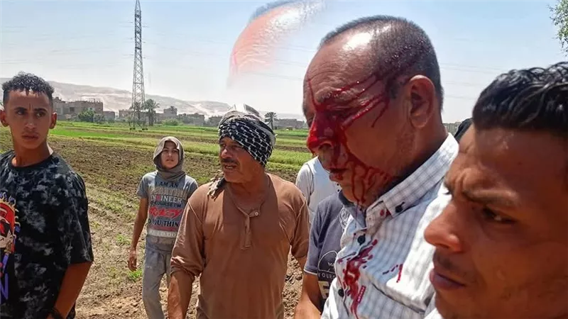 في موقف إنساني.. وزير الزراعة ومحافظ سوهاج يزوران موظفا أصيب خلال إزالة تعديات