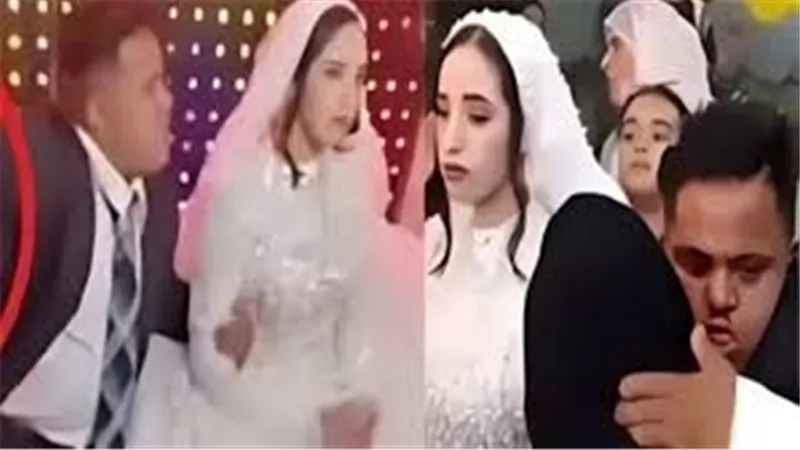 زواج فتاة قاصر من ذوي متلازمة داون يثير الجدل.. 