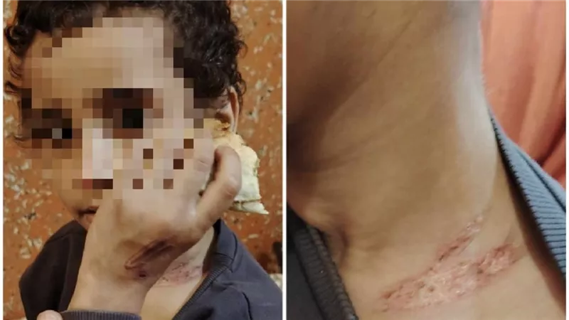ضحية جديدة لخراب البيوت.. من ينقذ «فاطمة» من عذاب زوج الأم؟