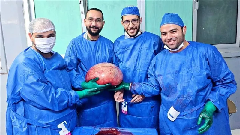 نجاح طبي جديد: استئصال ورم ضخم أنقذ حياة فتاة بمستشفى الفيوم العام