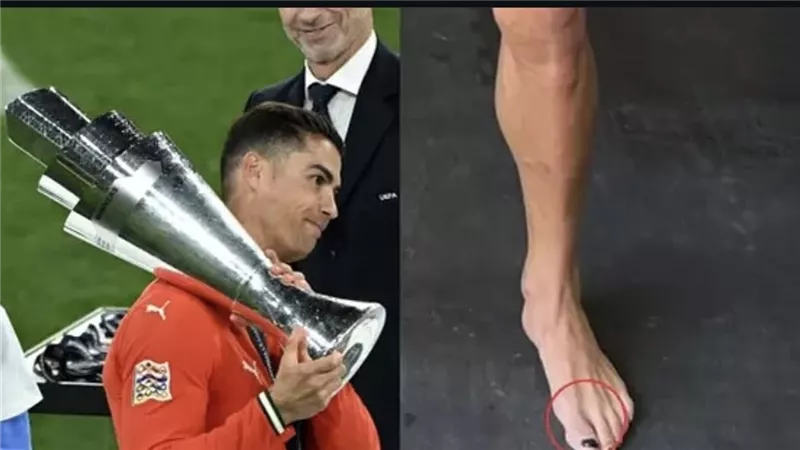 ليس طلاء أظافر ..لماذا صبغ كريستيانو رونالدو أظافر قدميه بالأسود ؟
