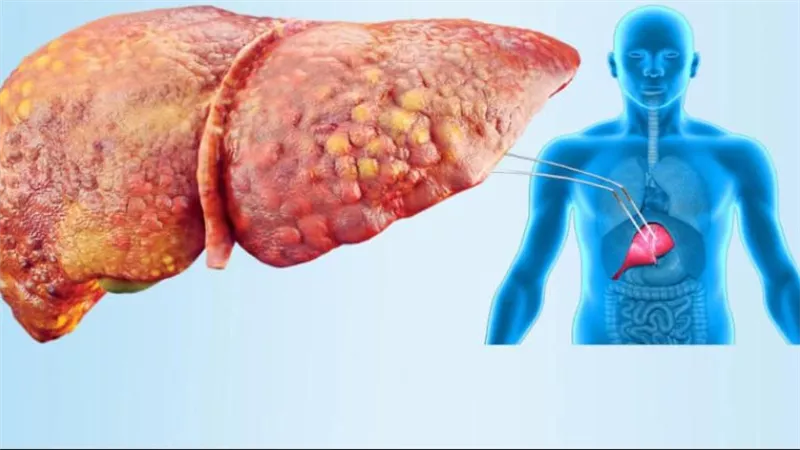 لعلاج دهون الكبد.. تناول هذه البذور يوميًا لدعم صحة الكبد الدهني