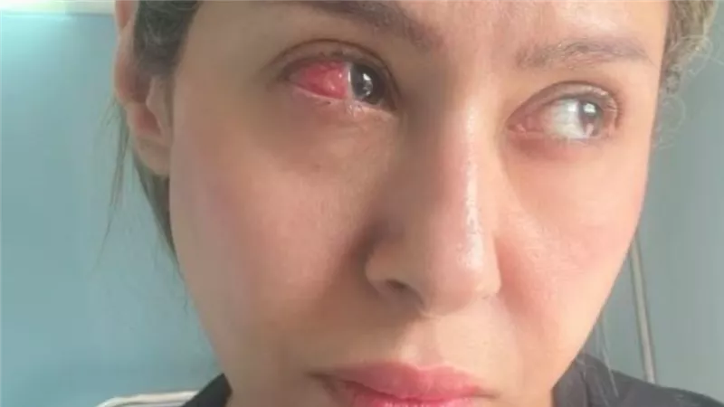 بسبب خطاء طبي.. إيناس عز الدين تخضع لعملية جراحية عاجلة 