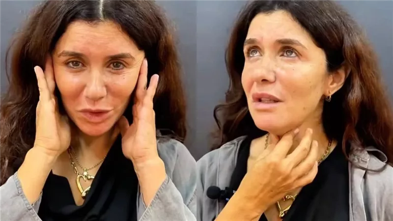 غادة عادل ليست الوحيدة.. نجمات خضعن إلي عمليات التجميل 