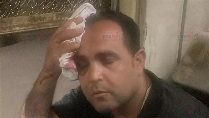 إصابة مواطن بعد رشقه بالحجارة خلال استقلاله قطار منوف قرب محطة شطانوف