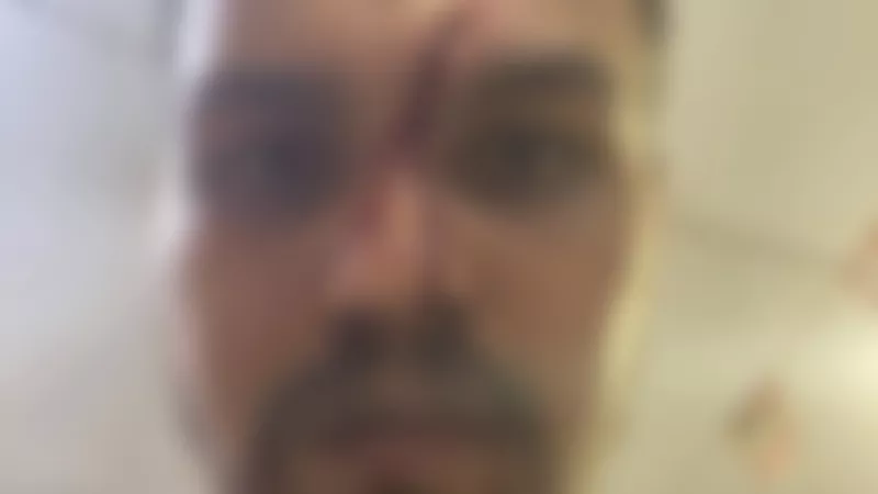 بسبب 5 جنيهات.. سائق ميكروباص يتعدى على راكب بسلاح أبيض فى البراجيل 