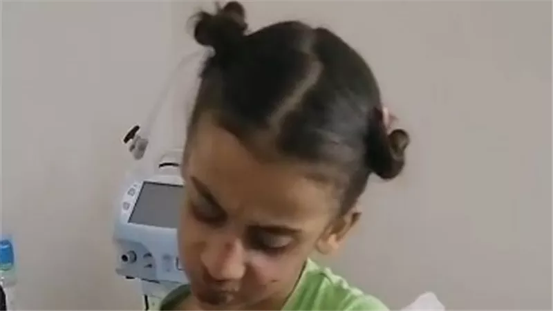 مستشفى العجمي يستقبل أطفال التعذيب بالإسكندرية لتقديم الرعاية الصحية والنفسية