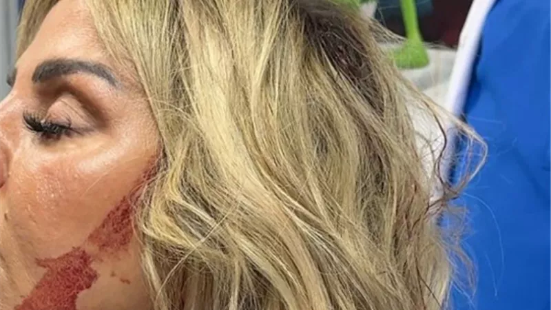 رزان مغربي تتعافى بعد حادث سقوط سقف الفندق وتوجه رسالة شكر لجمهورها