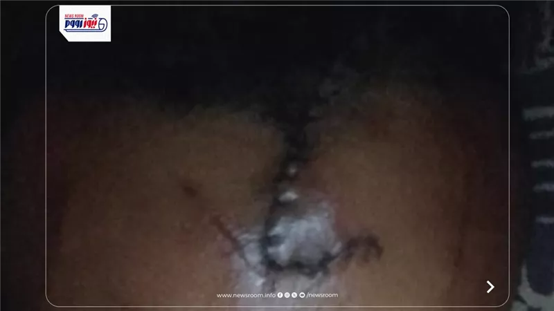 المتهم قاعدلى بالسلاح بالشارع.. شاب يستغيث بعد إصابته بعاهة بمشاجرة بالبساتين