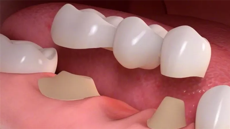ما حكم بيع الأسنان المخلوعة للأطباء وطلاب كليات الطب؟ الإفتاء توضح