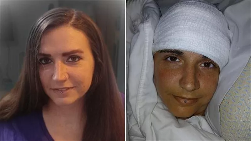 بعد 20 عامًا من الشلل.. امرأة تستعيد القدرة على الكتابة بفضل شريحة «نيورالينك»
