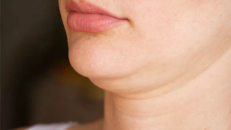بدون عمليات تجميل.. 5  تمارين بسيطة للوجه تساعدك في التخلص من 