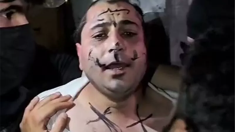 شاهد لحظة قص شعر المطرب الشعبي عمر خيري بعد القبض عليه بسوريا
