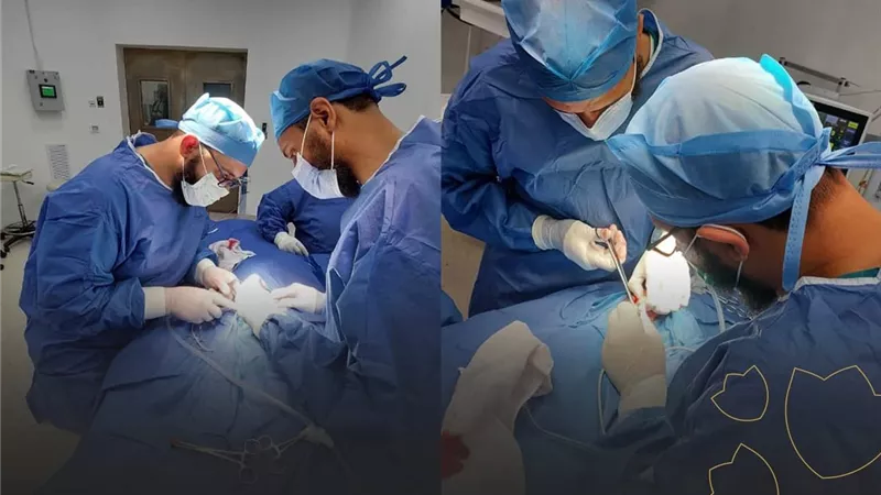  لأول مرة بالسويس.. جراحة نادرة تنقذ حياة طفل حديث الولادة بهيئة الرعاية 
