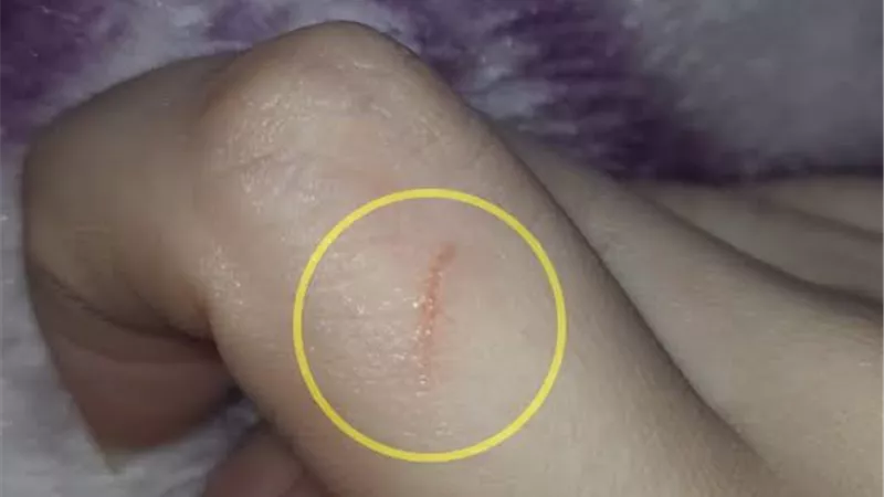 قطاع الطب الوقائي يحدّث الأدلة وضوابط الوقاية من مرض السعار