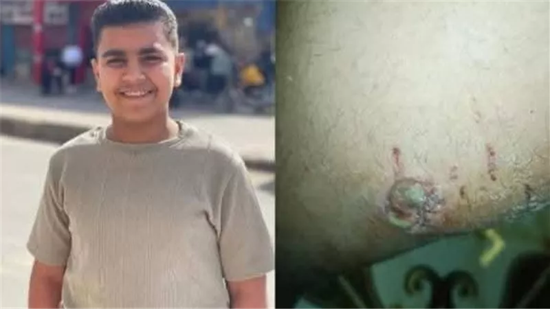 القبض على شخص أطلق كلب شرس على طفل من المصطافين ببورسعيد
