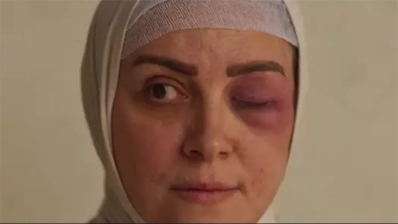 بعد اللجوء لها في ظلم المصطبة .. كل ما تريد معرفته عن «البشعة»