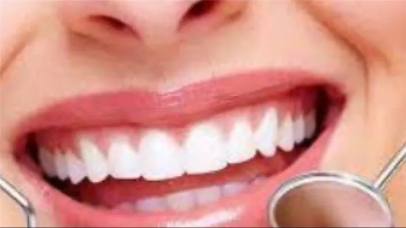 اليوم العالمي لصحة الفم: كشف الحقائق وراء أساطير العناية بالأسنان