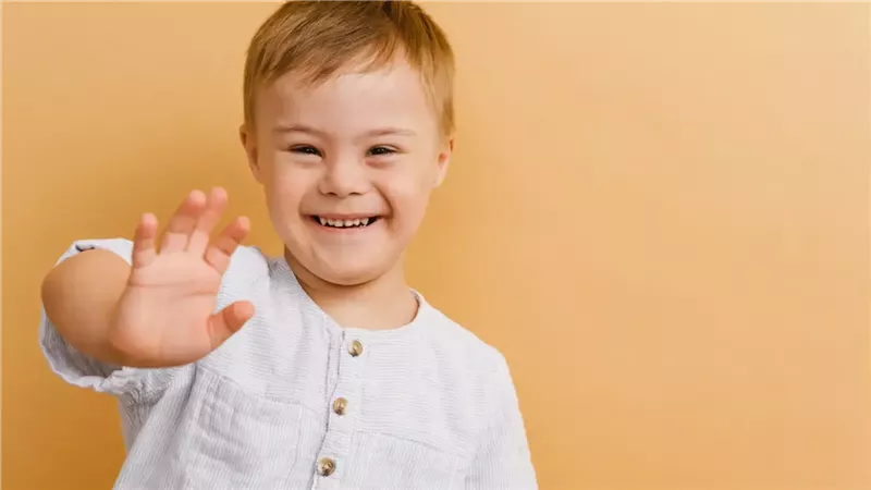 اليوم العالمي لمتلازمة داون.. واحد من كل ألف مولود فى العالم 