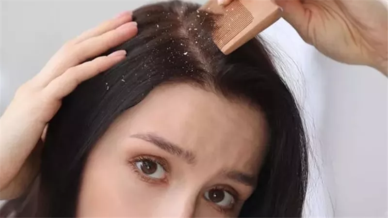 منها زيت 
