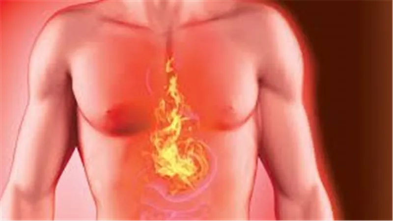 حرقان المعدة.. أسبابها الحقيقية وأفضل العلاجات المنزلية الفعّالة