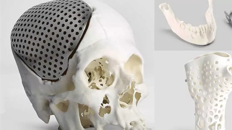 خطوة رائدة في الطب التجميلي.. أول زراعة لأنسجة مطبوعة بتقنية ثلاثية الأبعاد