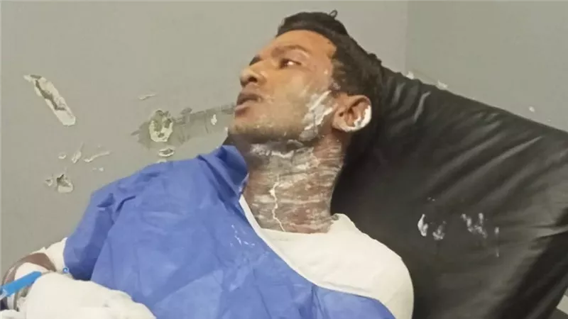 حلم الزواج تحول إلى كابوس ..احترقت شقة العريس و اكلت النيران جسده 