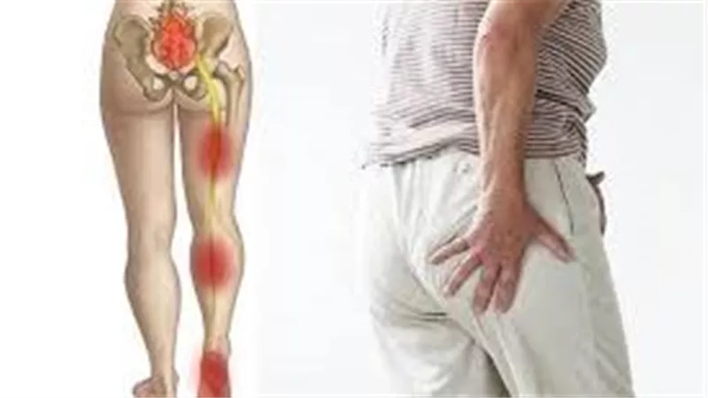 آلام عرق النسا كيف تحدث وأفضل الطرق للتخفيف من أعراضها