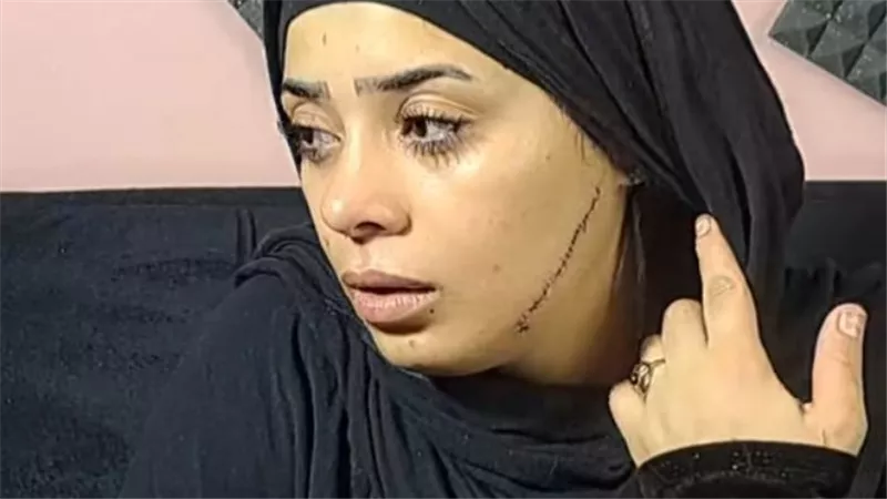 قبل أيام من زفافها.. مطلقة تشوه وجه عروس طليقها بمصر القديمة