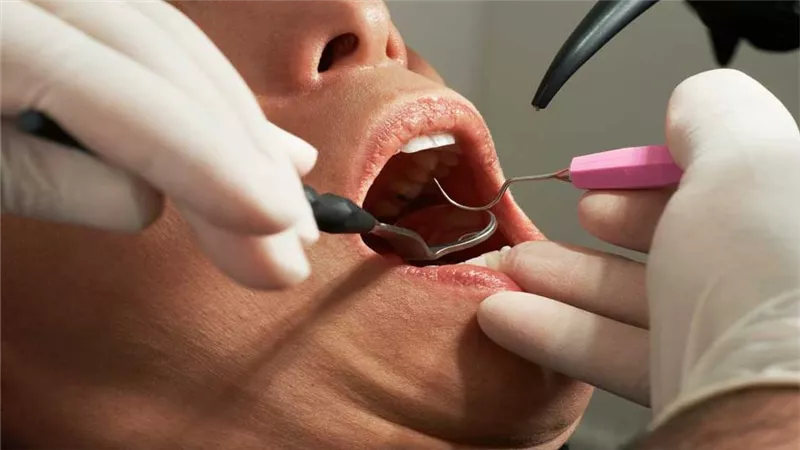 ما حكم زكاة عيادات الأسنان وما كيفيتها؟.. الإفتاء توضح 