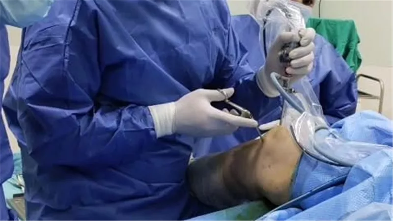  نجاح عملية منظار ركبة بمستشفى السادات المركزي ضمن مبادرة تخفيض أسعار العمليات