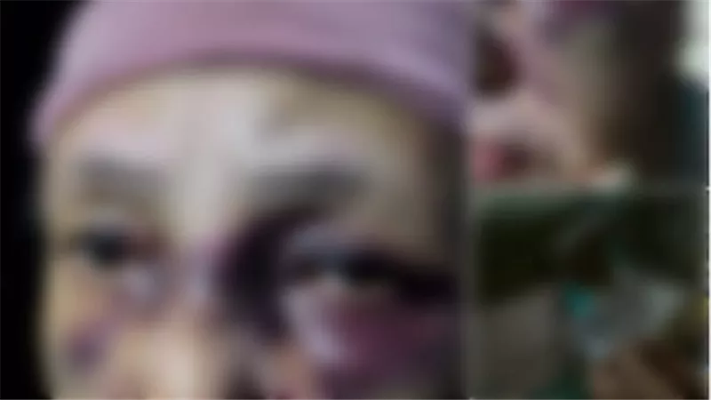 الأمن يكشف ملابسات واقعة اعتداء شخص على والدة زوجته بشبرا الخيمة 