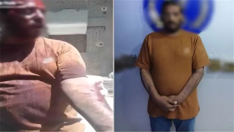 جرح نفسه.. الأمن يكشف حقيقة اتهام شخص لرجال شرطة التبين بالاعتداء عليه