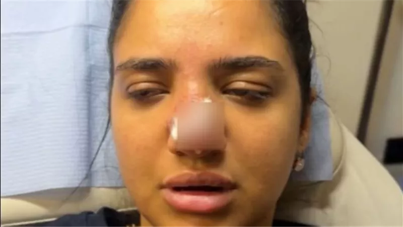 شام الذهبي تعلق على أزمة كنزي مدبولي: واجب الطيب شرح خطورة العملية قبل الإجراء