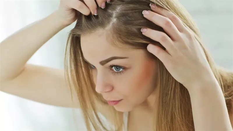 لإعادة نمو الشعر بسرعة.. مكونات لخلطها مع زيت الخردل