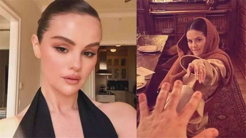 بعد إصابة سيلينا جوميز.. كيف يؤدي مرض الذئبة إلى إثارة التهاب المفاصل؟