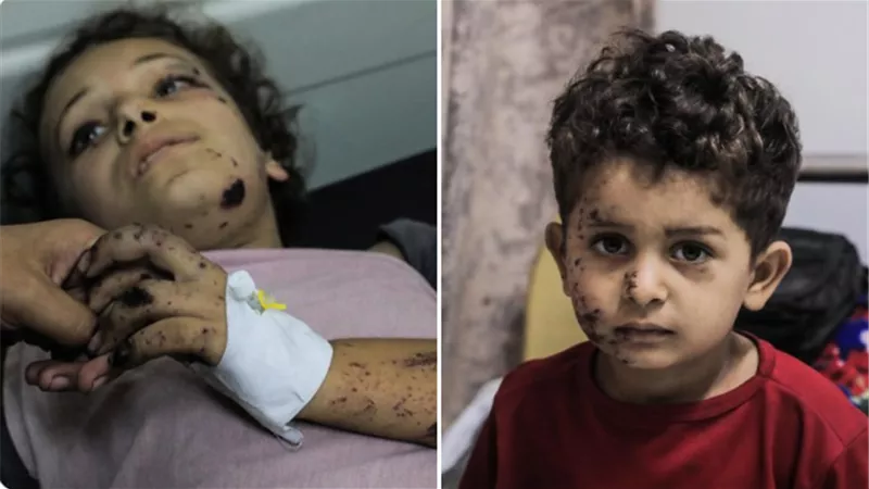 اليونيسف: نعمل على حماية أطفال غزة لكنهم بحاجة لوقف إطلاق النار الآن