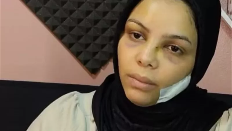 ثلاث سنوات من العذاب.. قصة مأساوية لزوجة تعرضت للتعذيب والتشويه في بولاق