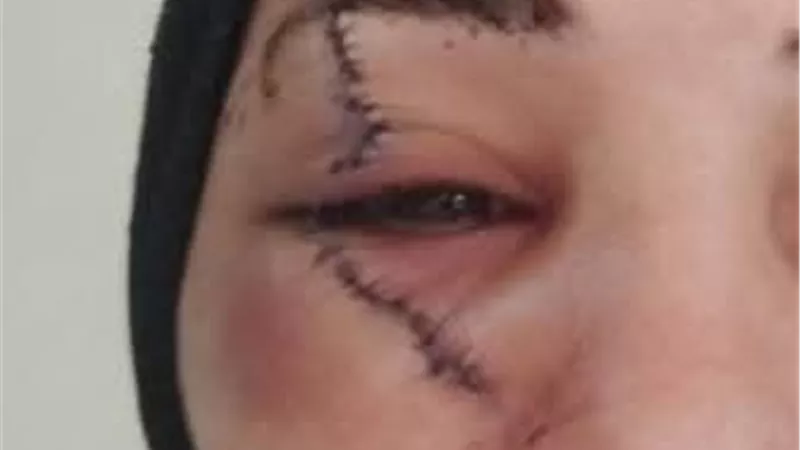 حبس المتهم بتقطيع وجه زوجته 4 أيام على ذمة التحقيقات