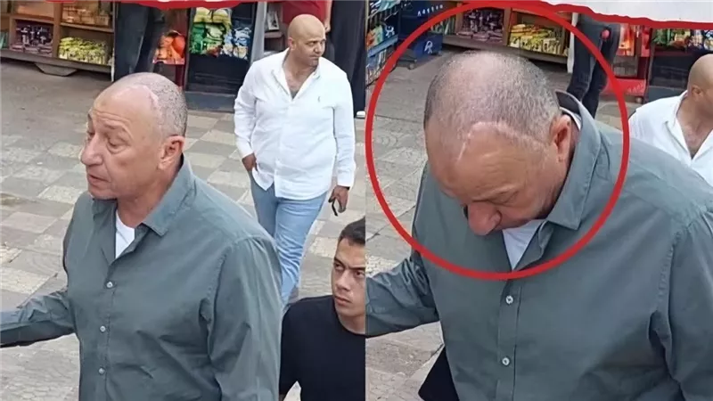 بملامح متعبة وأثر جرح في رأسه.. أزمات صحية خطيرة واجهها محمود الخطيب