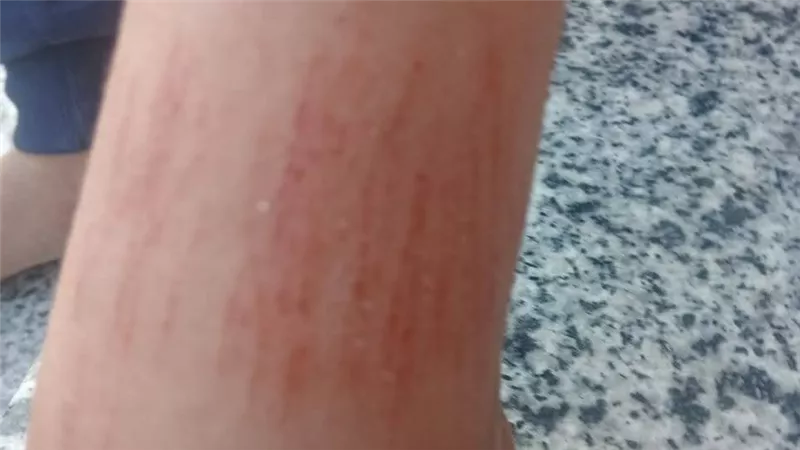 بسبب ضرب طالب.. استبعاد مدير مدرسة ومعلمة بعد اعتدائها على تلميذ في طوخ