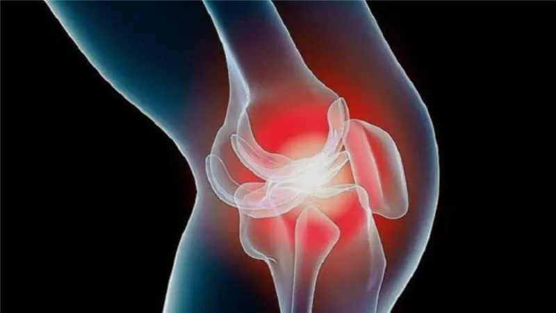 ممارسة الرياضة بانتظام… الحل الطبيعي لتقليل ألم التهاب المفاصل
